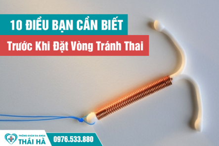 10 Điều Bạn Cần Biết Trước Khi Đặt Vòng Tránh Thai