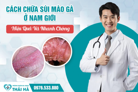 Cách Chữa Sùi Mào Gà Ở Nam Giới Hiệu Quả Và Nhanh Chóng