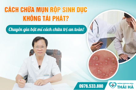 Cách chữa mụn rộp sinh dục không tái phát? Chuyên gia bật mí cách chữa trị an toàn!