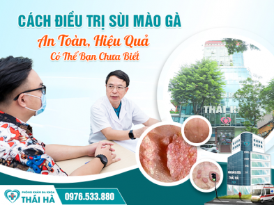Cách Điều Trị Sùi Mào Gà An Toàn, Hiệu Quả Có Thể Bạn Chưa Biết