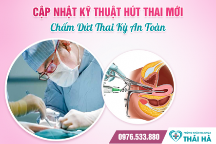 Cập Nhật Kỹ Thuật Hút Thai Mới, Chấm Dứt Thai Kỳ An Toàn
