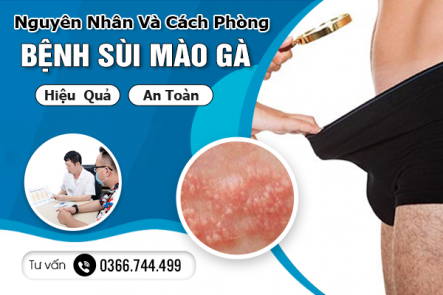 Nguyên Nhân Và Cách Phòng Bệnh Sùi Mào Gà Hiệu Quả, An Toàn